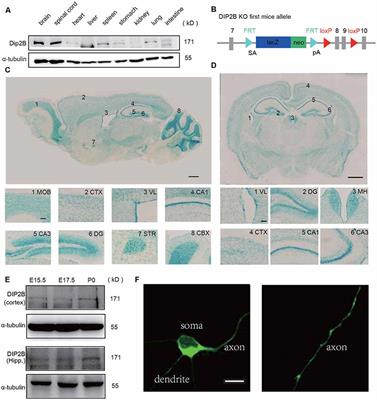 DIP2B Interacts With α-Tubulin to Regulate Axon Outgrowth